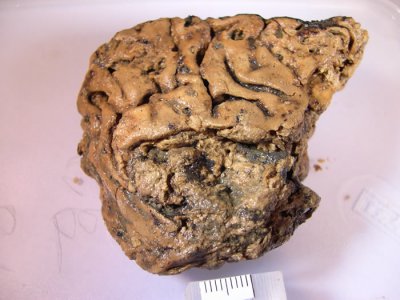 ​英国约克郡2600年前被杀古人颅骨内发现保存完好的神秘脑组织