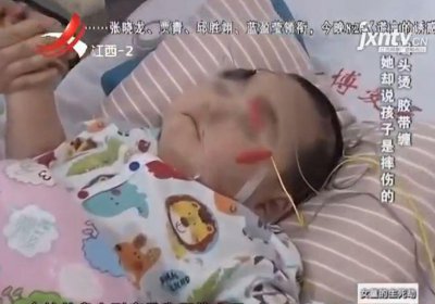 ​两岁女童遭男子虐待 烟头烫胶带缠 生母竟只在一旁看着（上）